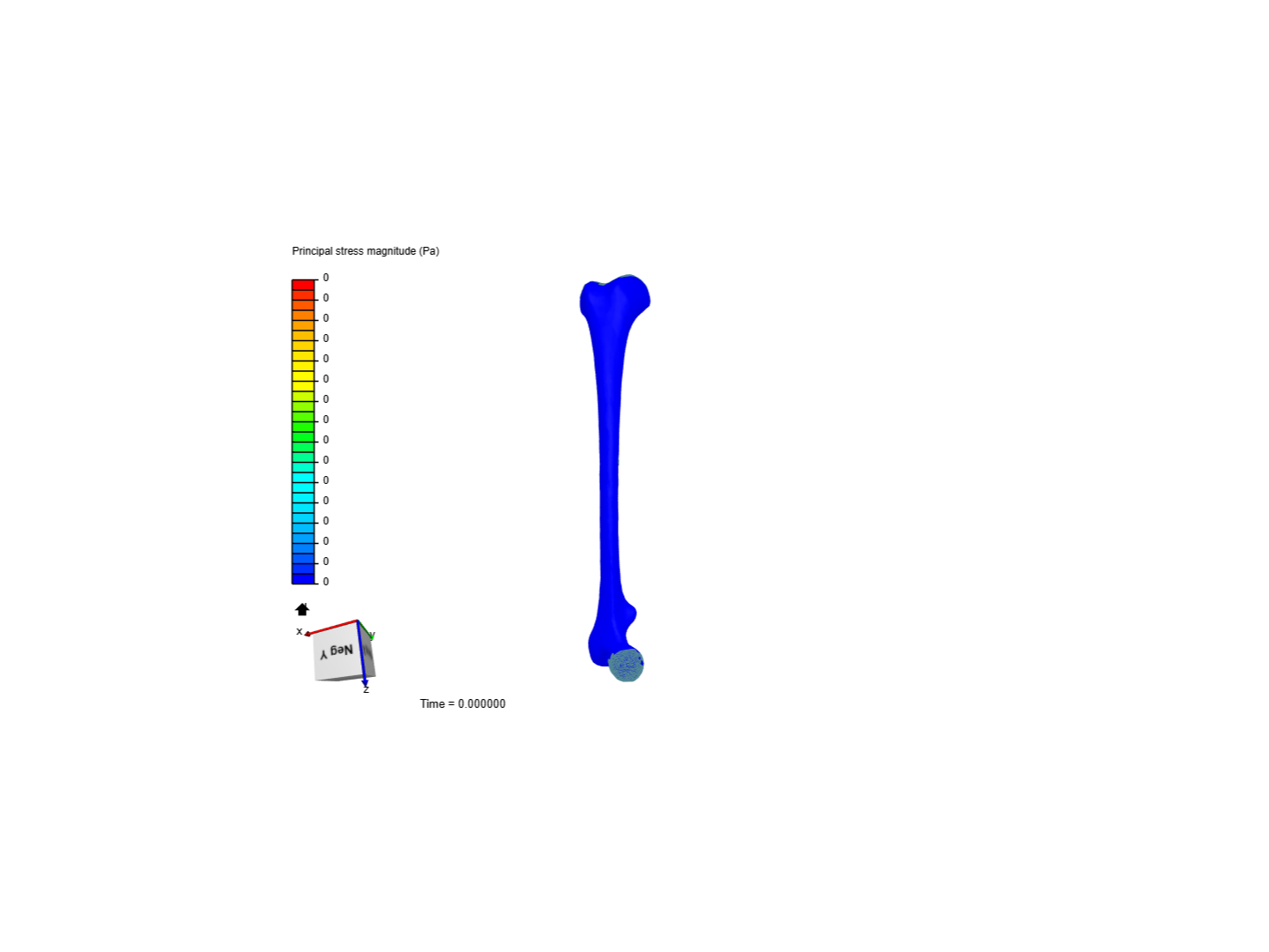 Design and analysis on Femur Bone image