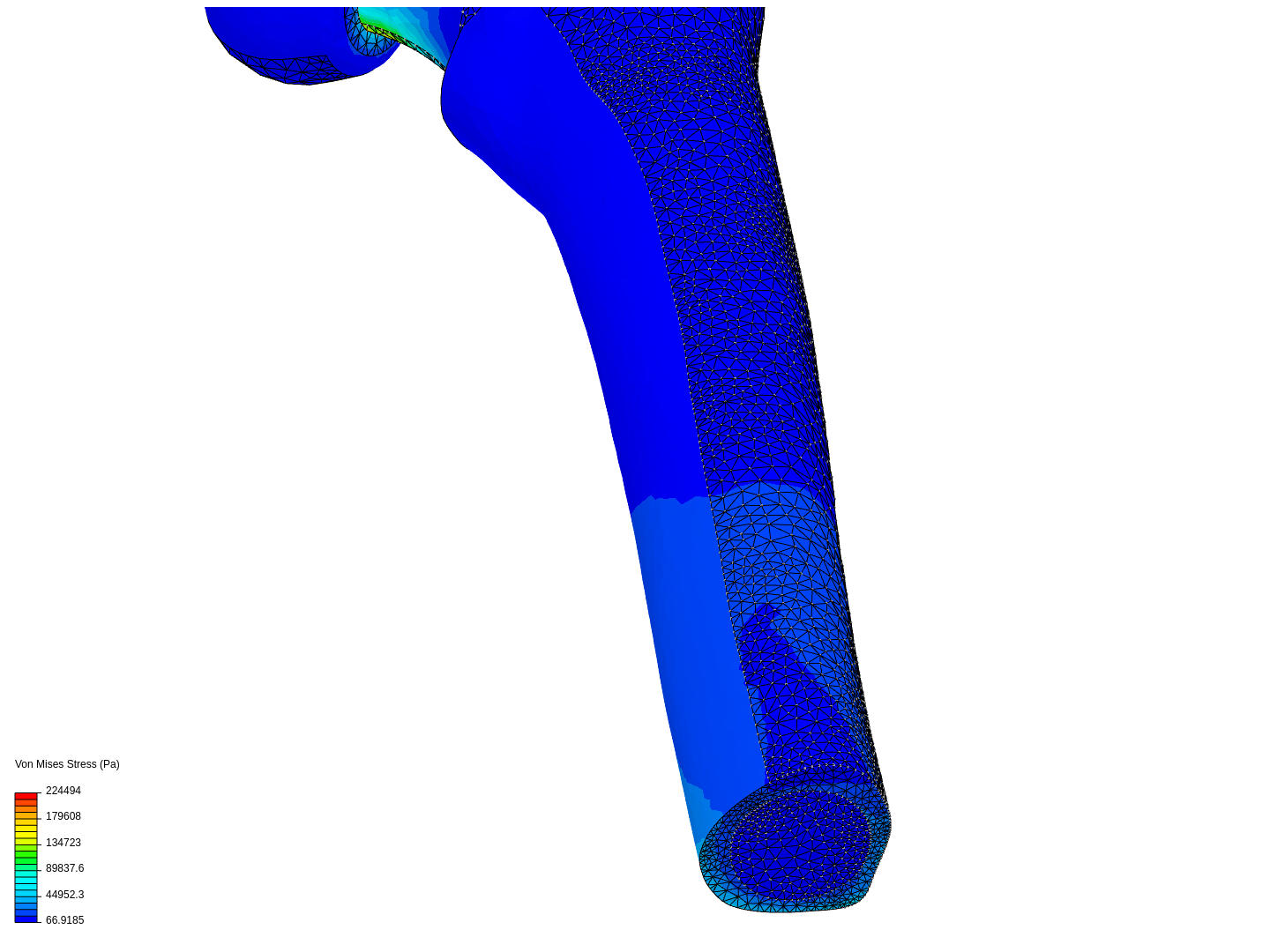 Hip prothesis image