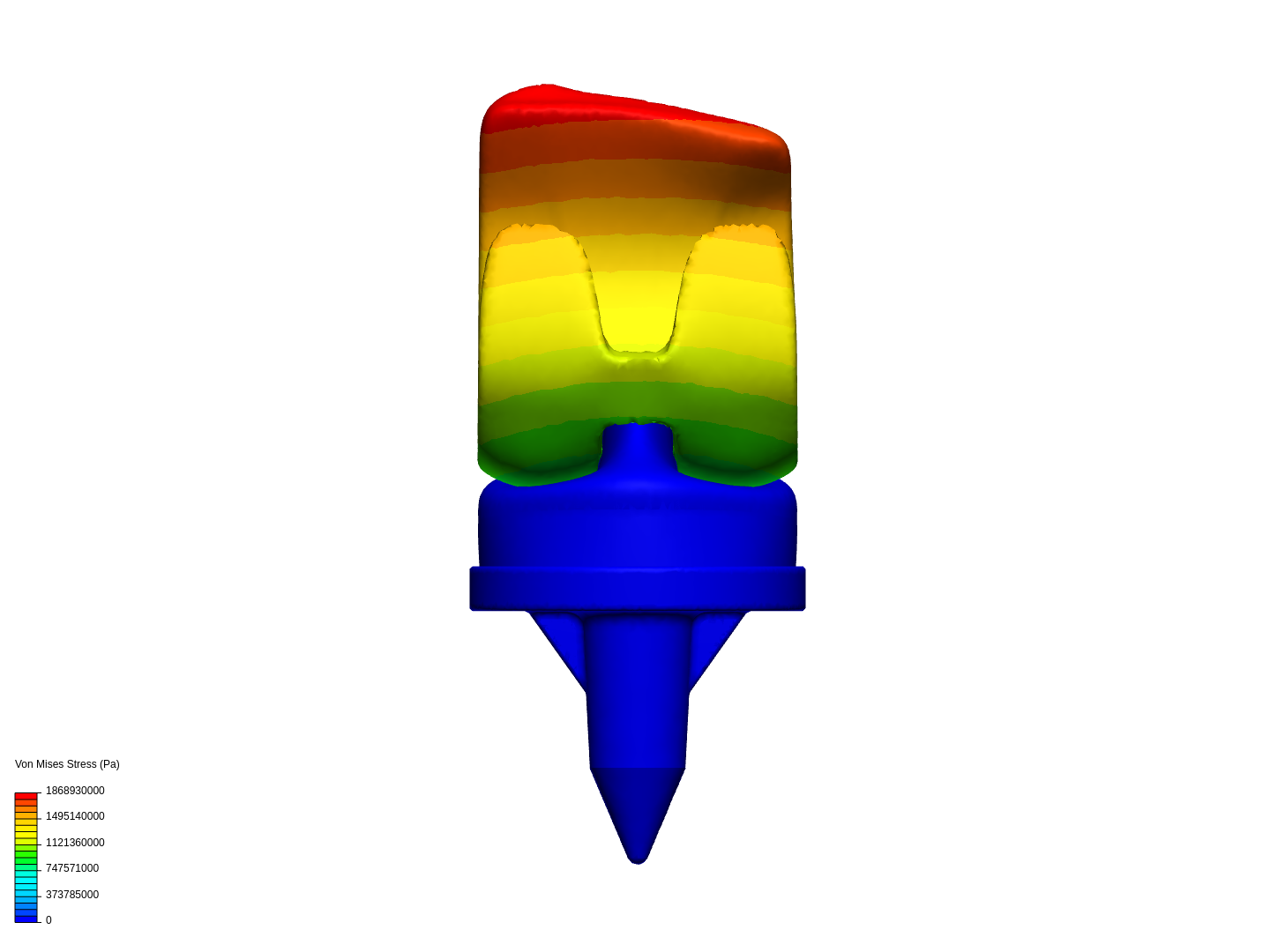 TKR tibal baseplate image