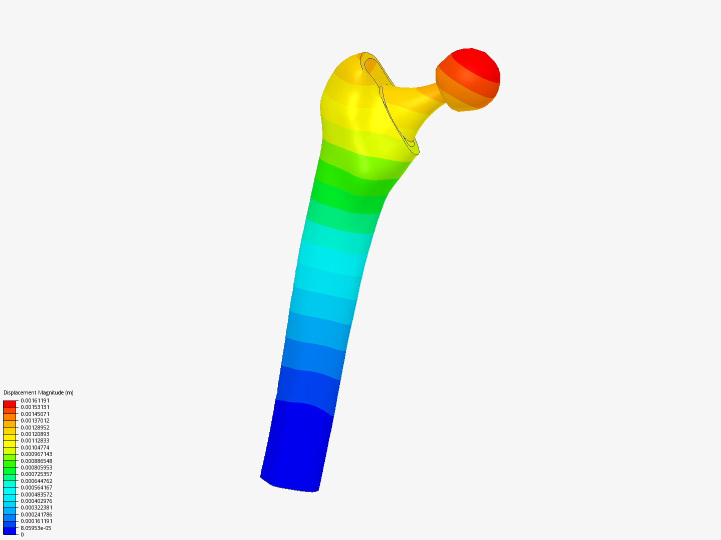 Hip Joint prosthetis image