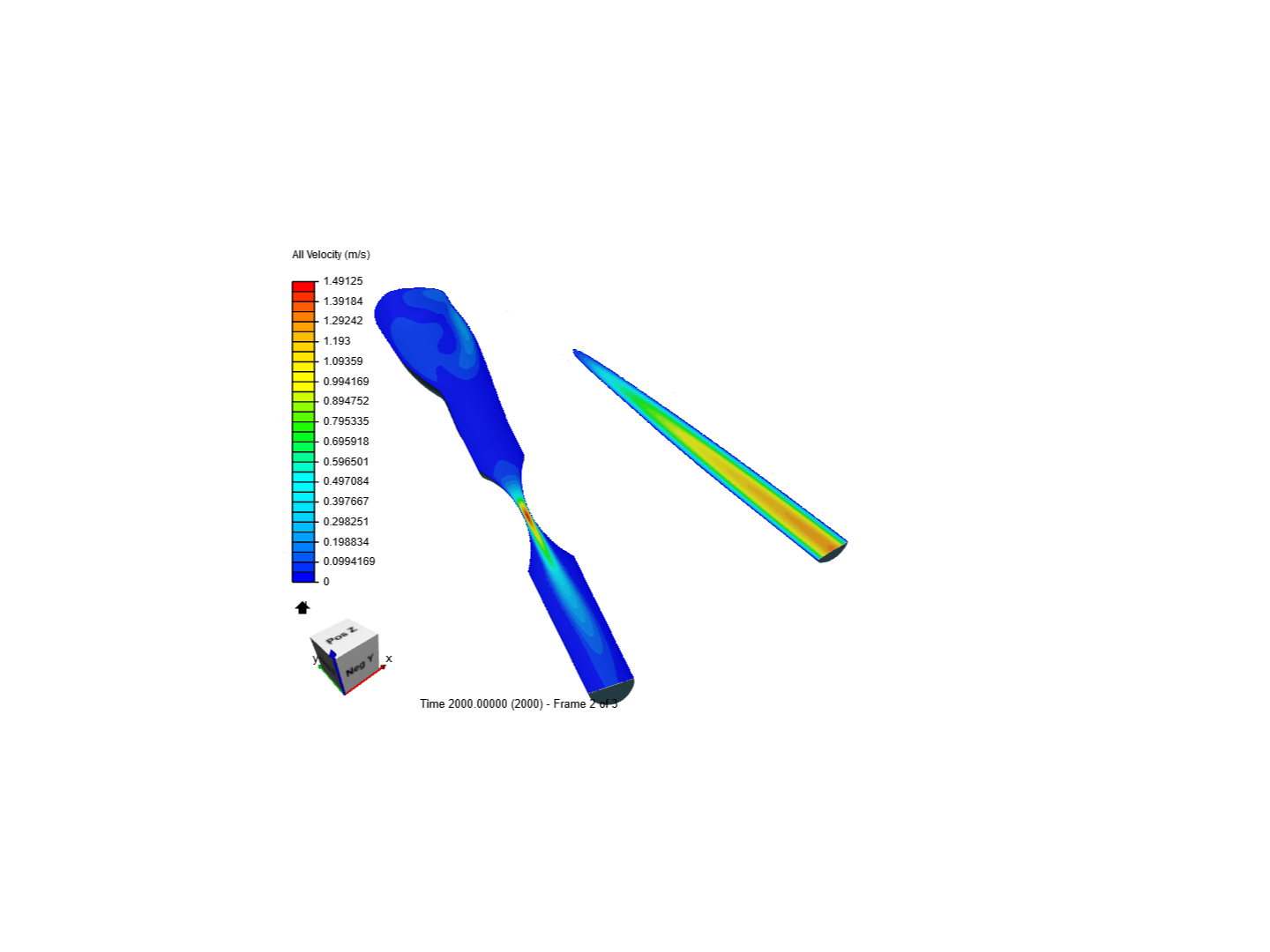 Carotid artery bifurcation test image