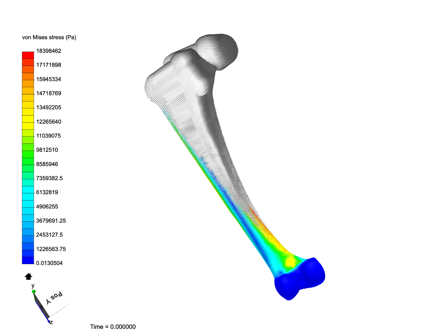 fémur2 image