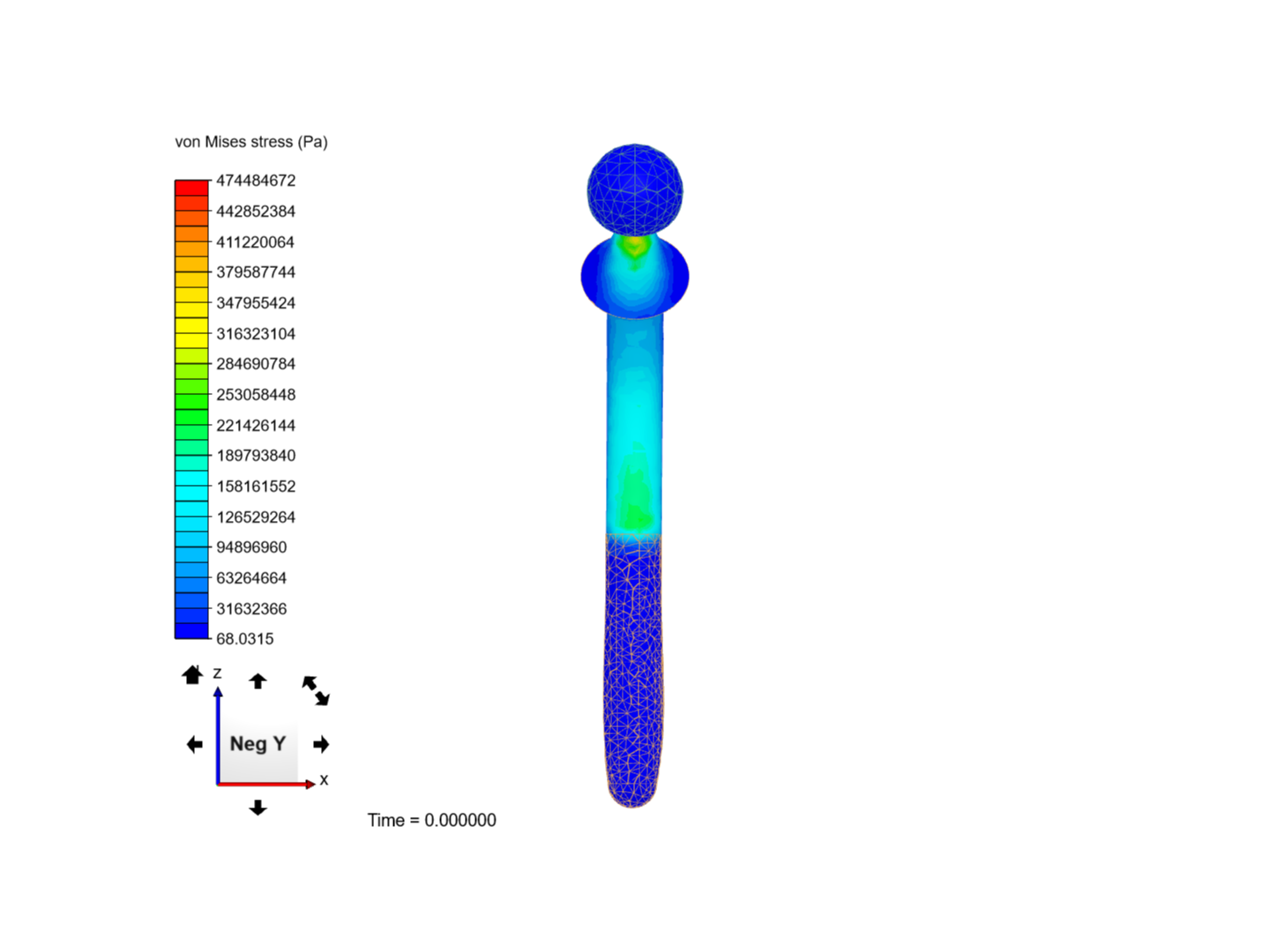 TP_Biomeca_Prothèse image