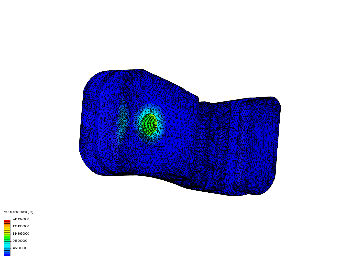 Prosthetic foot image