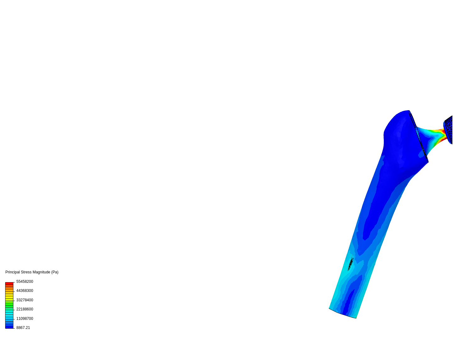 BIOM 421 Hip Joint image