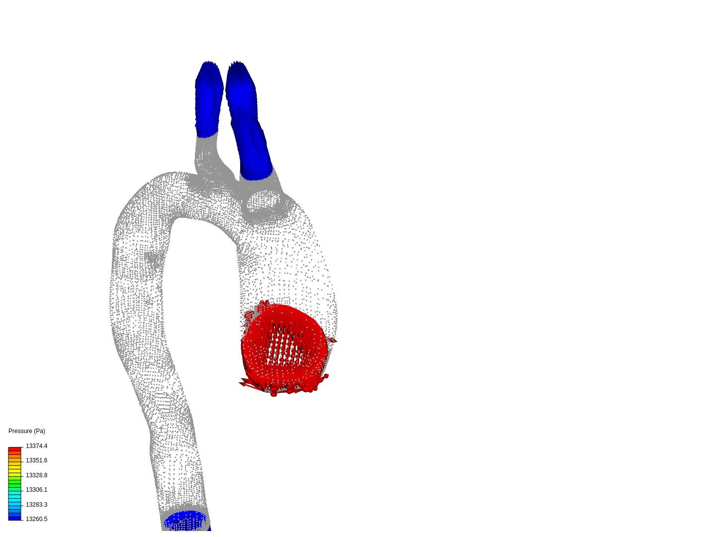 aorta image