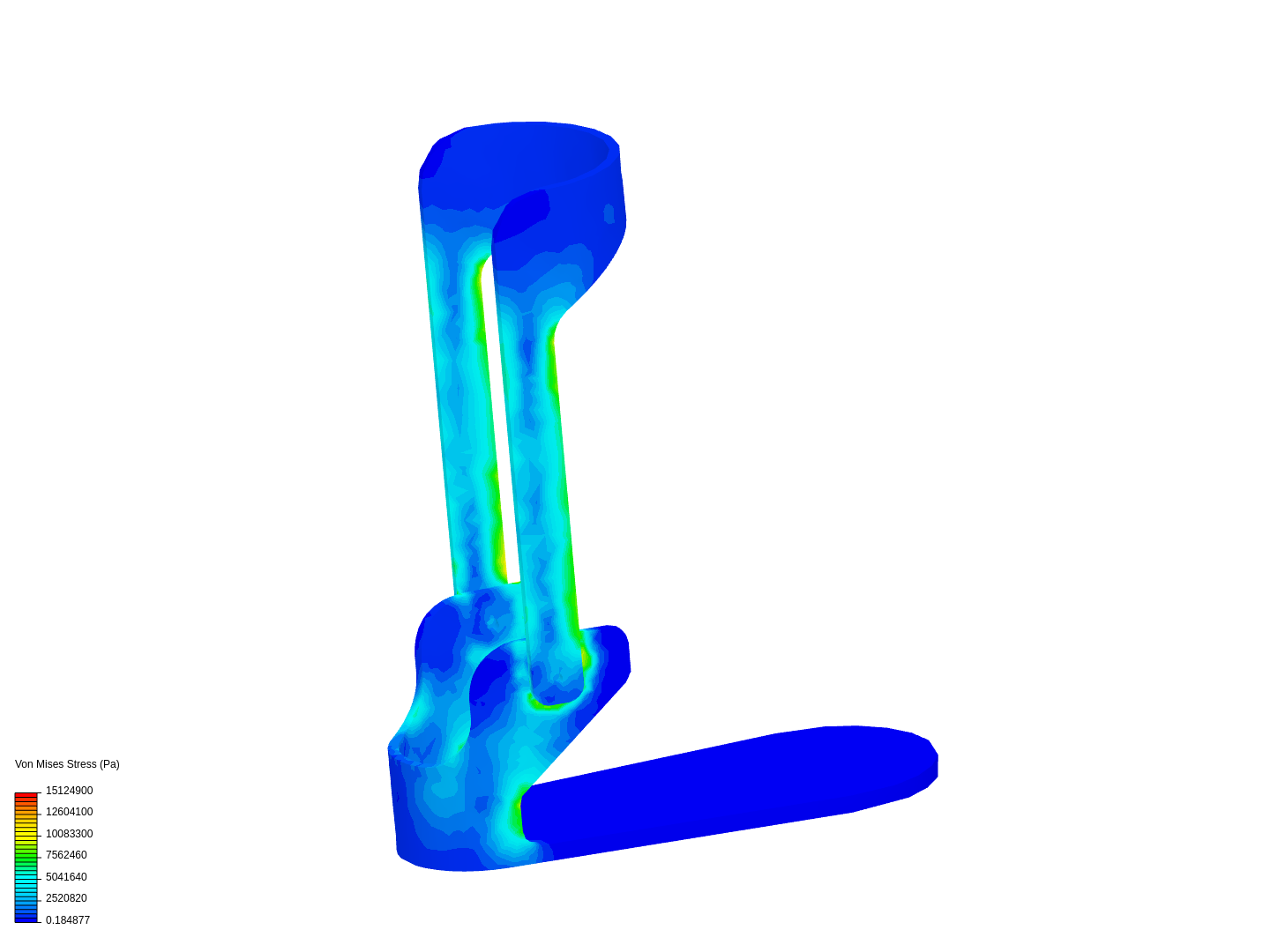 abs protesis image