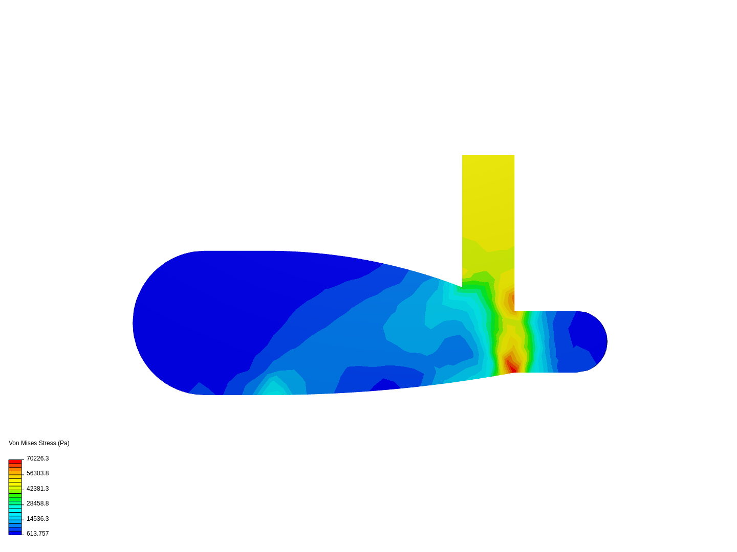 Prosthetic foot image