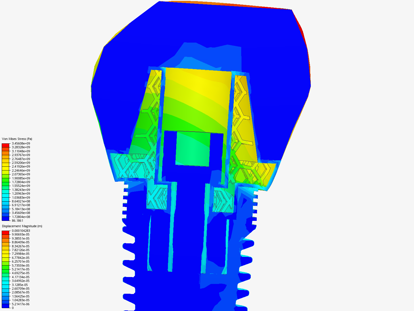 Implant image