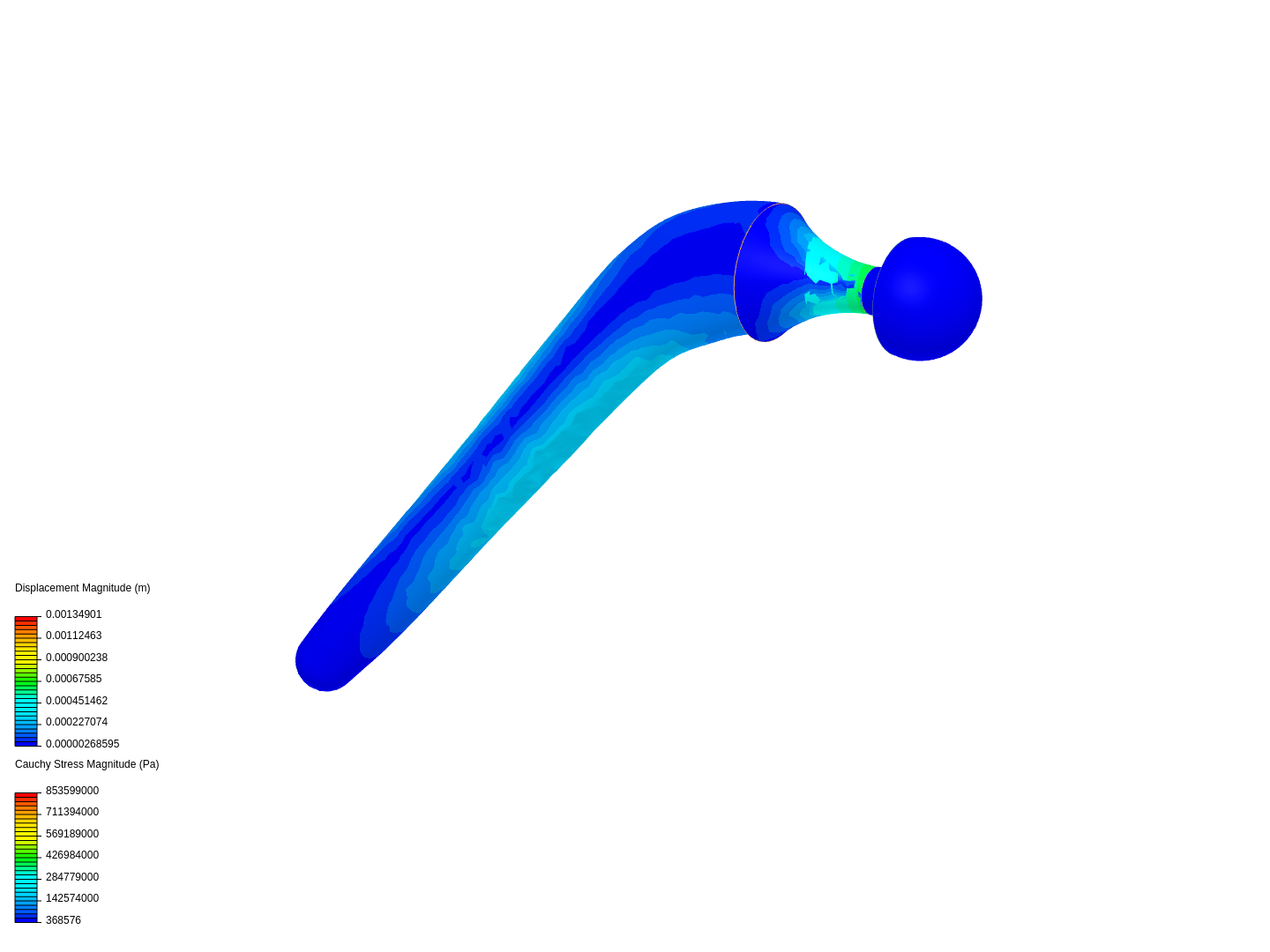 hip prothesis image