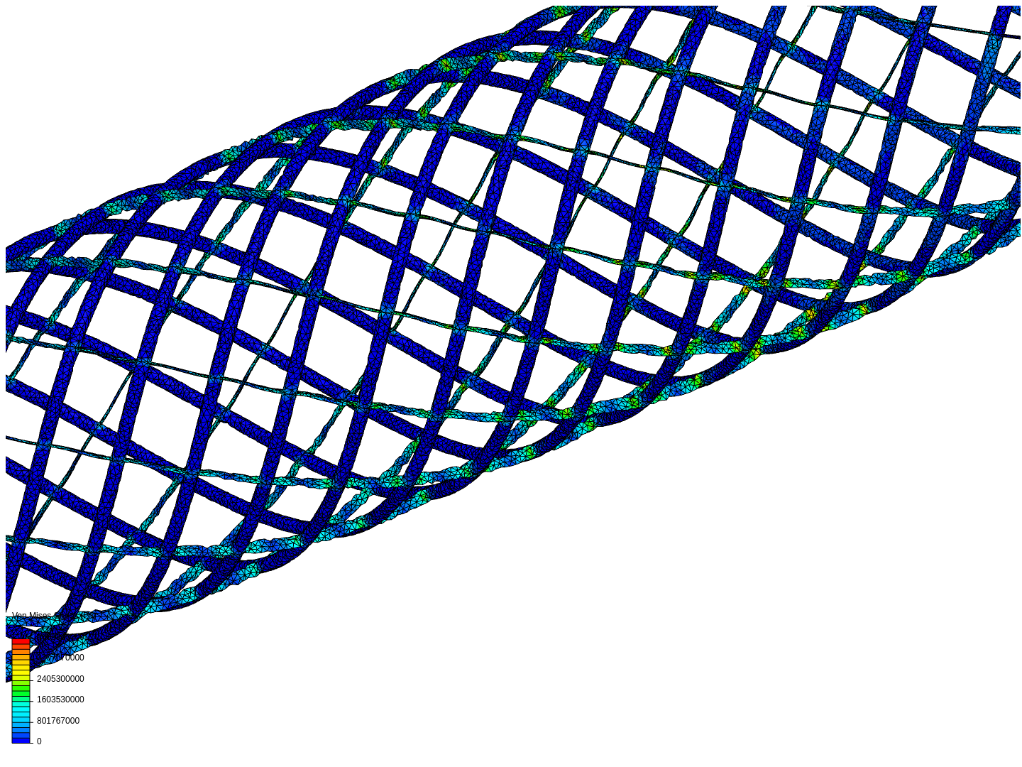 MyStent image