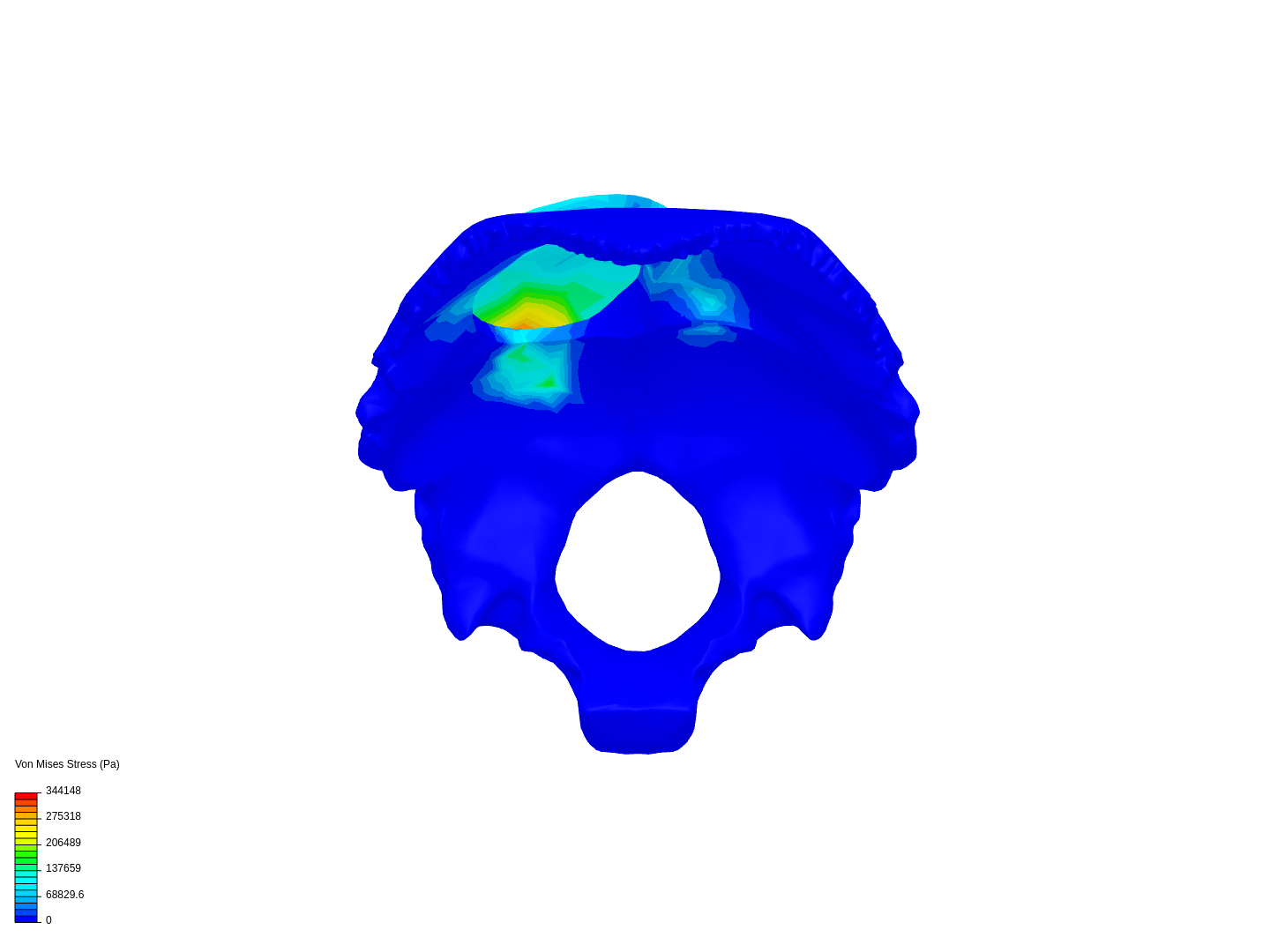 Ensamble occipital image