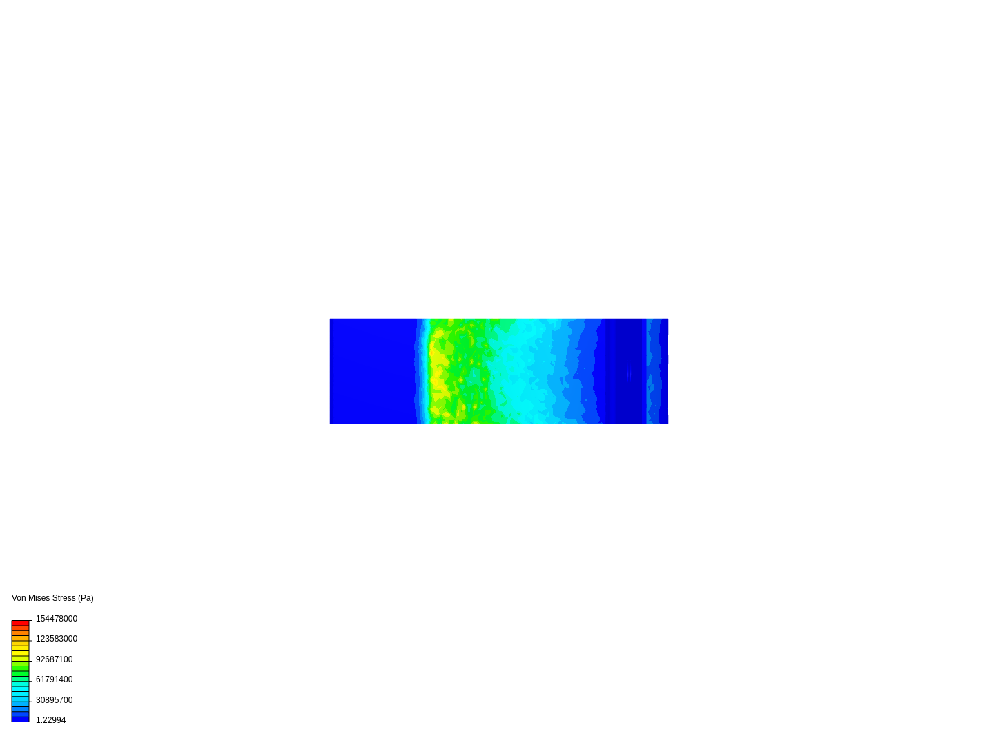 Prothèse de jambe image