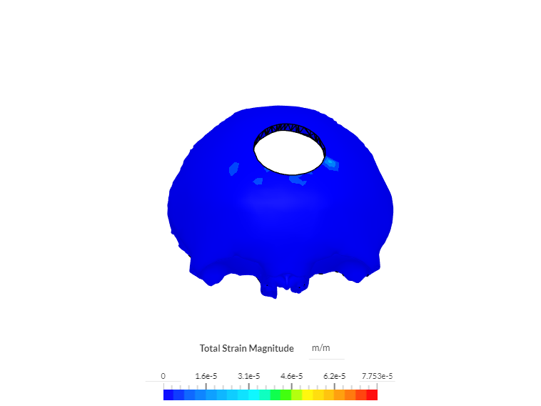 cranial frontal image