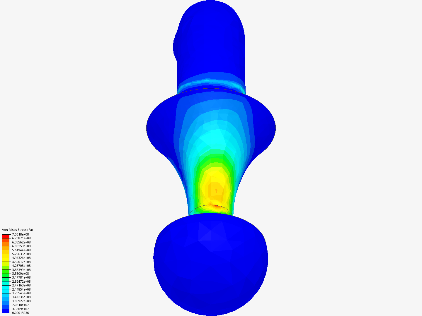 Protesis image