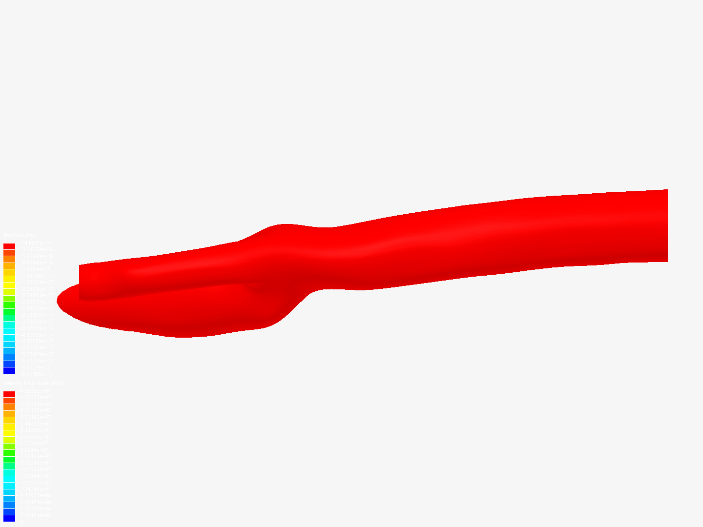 simulation of blood flow in bifurcated artery - Copy image