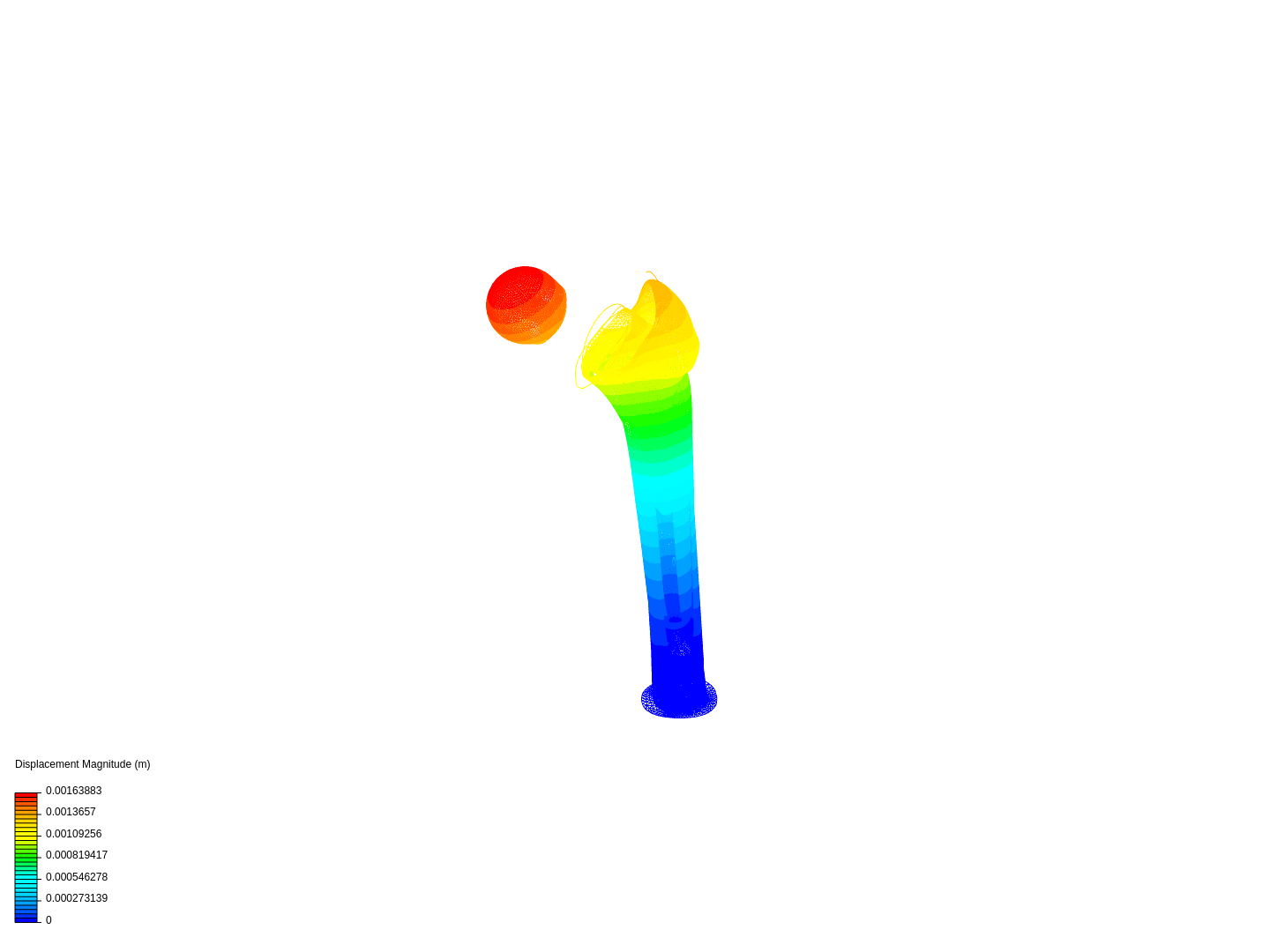 hip joint prosthesis image