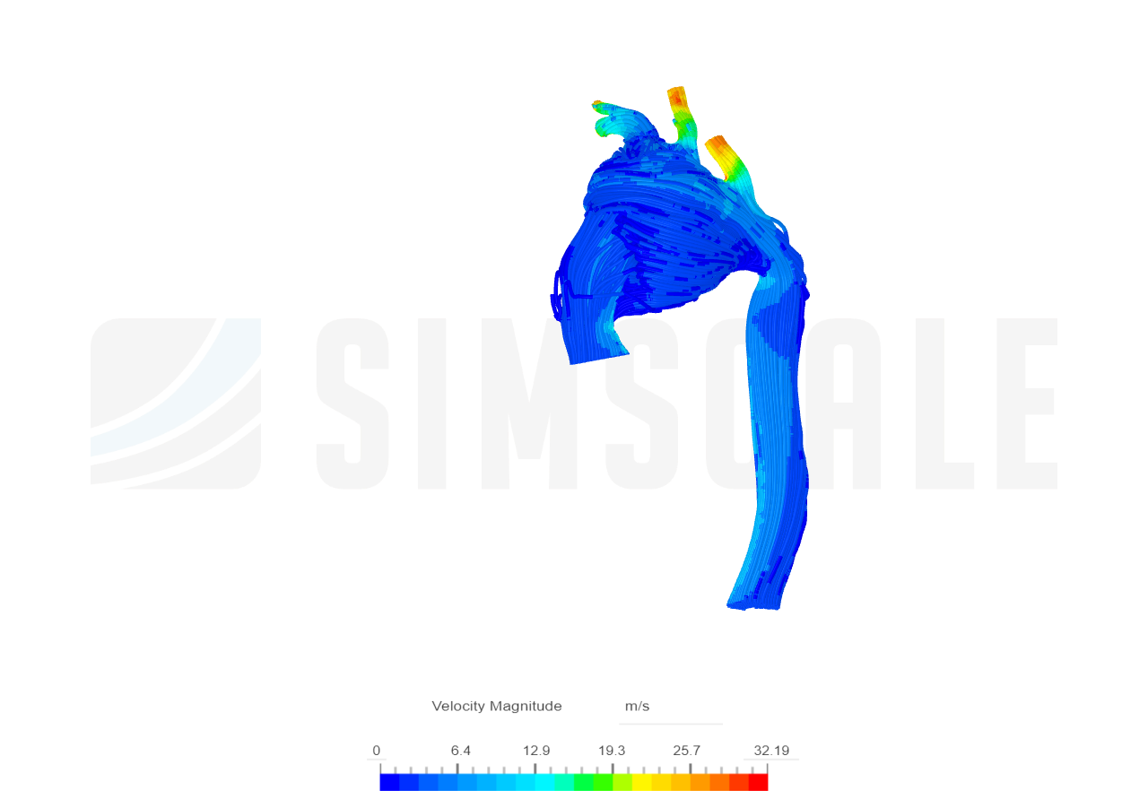 Aorta Blood Flow Simulation image