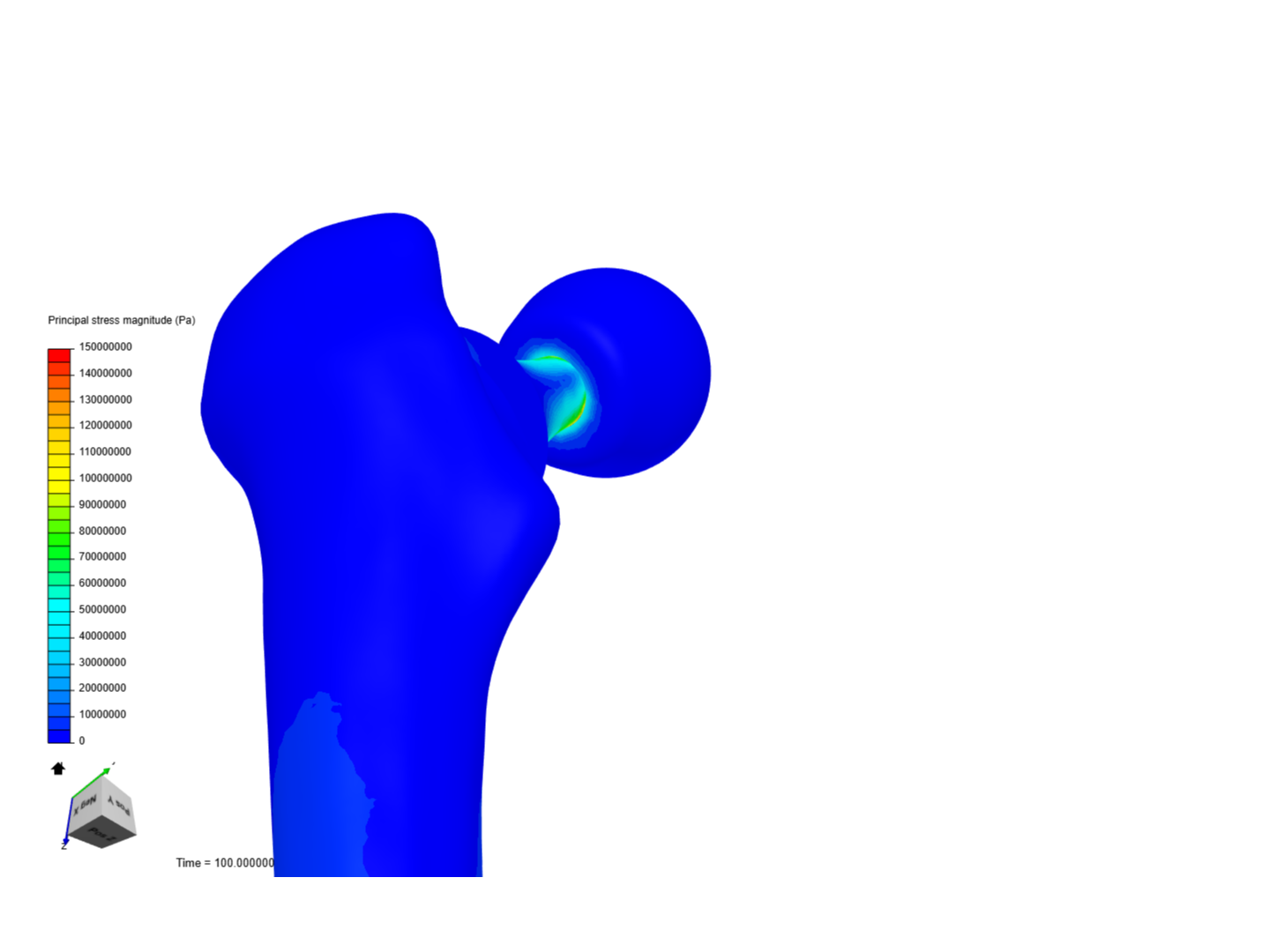 Biomaterials Hip Replacement image