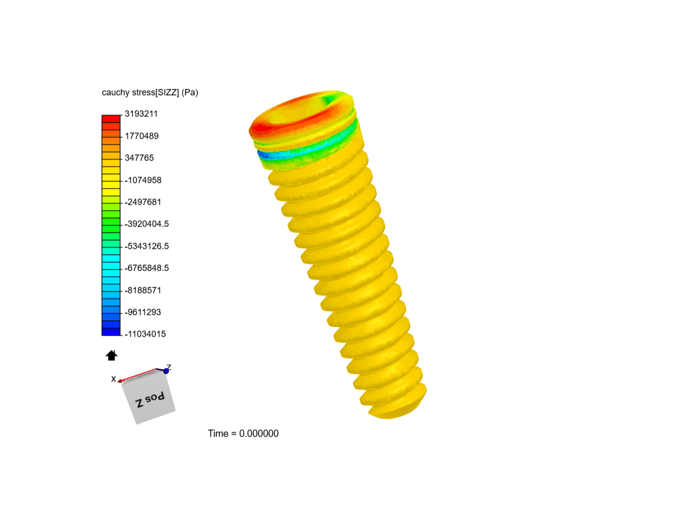 dental implant image