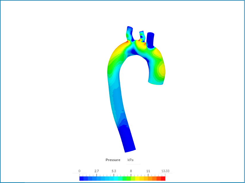 AortaCFD image