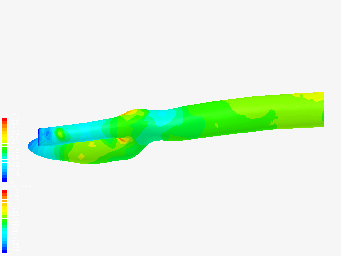 flow through carotid artery bifurcation - Copy image