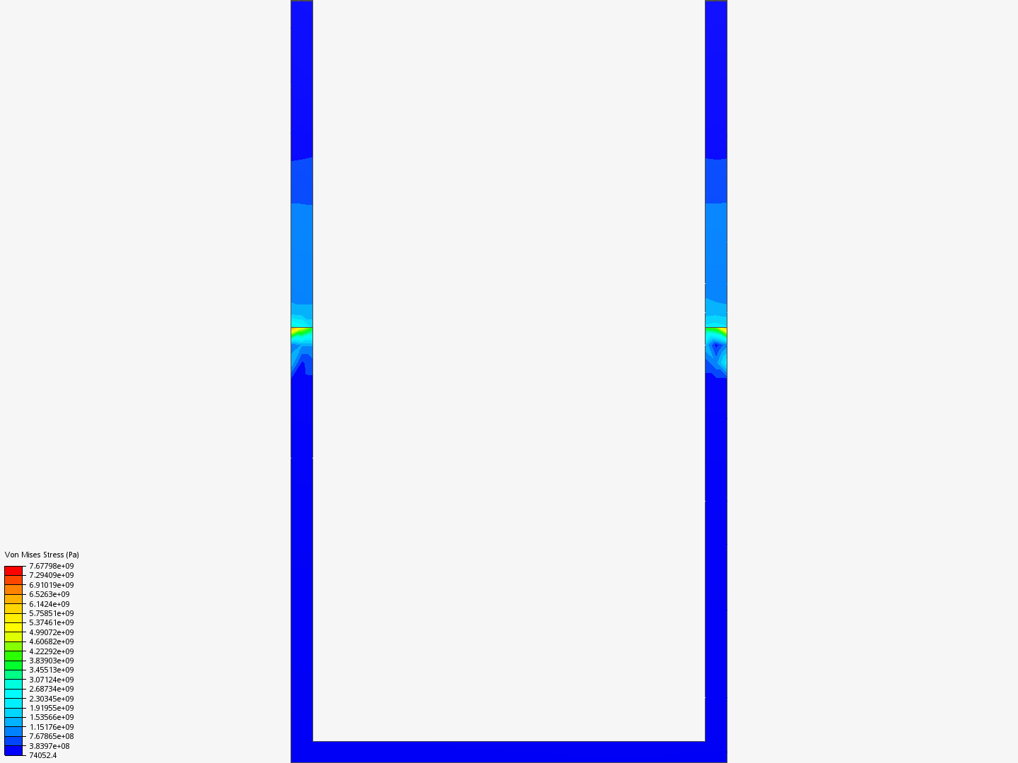 bracket2 image