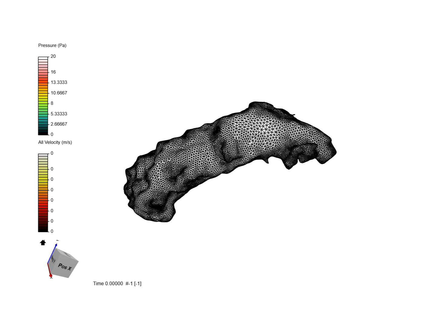 Pulmonary artery 3D flow sim - 4DF - CVI image