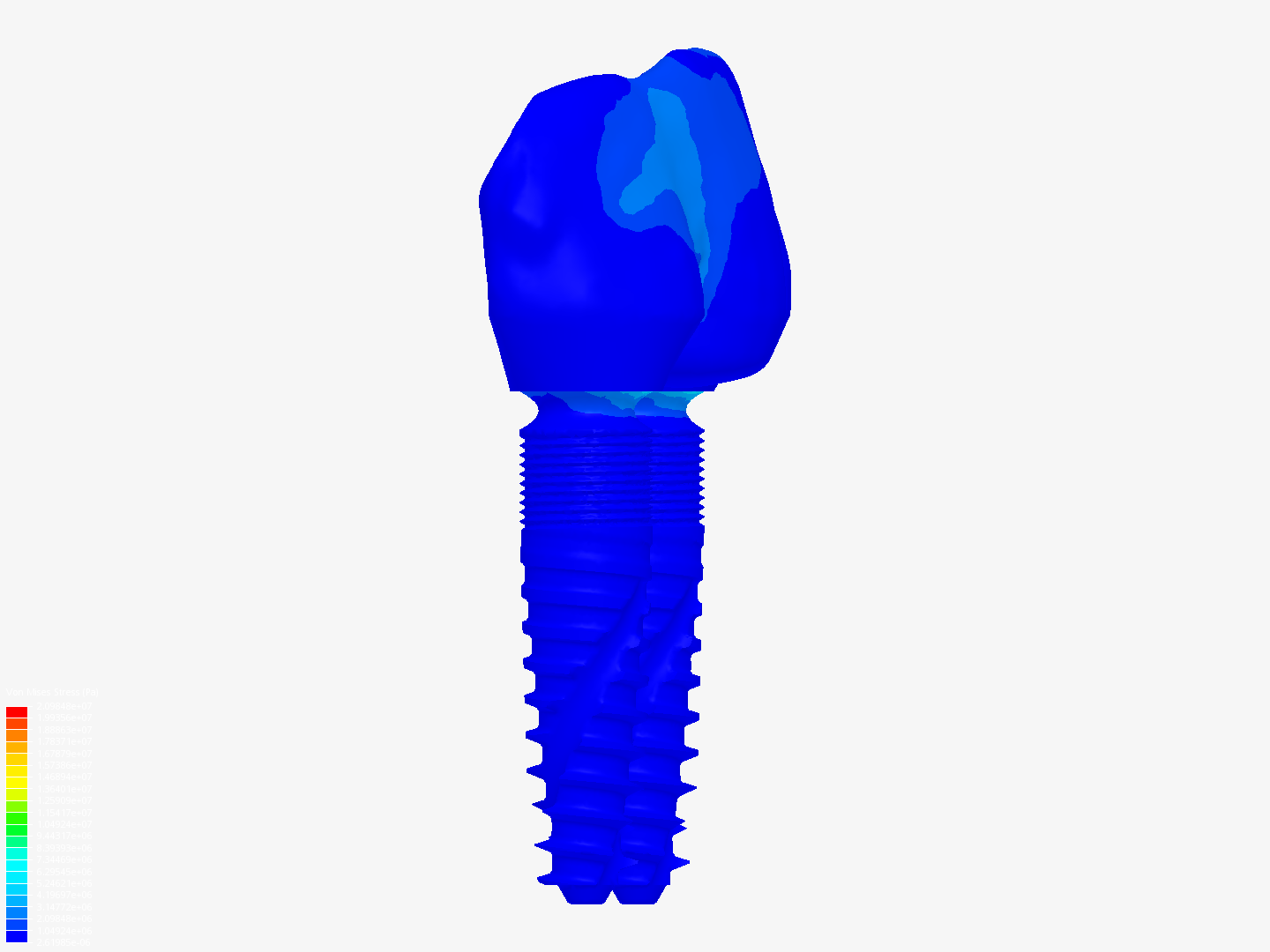 Dental Bridge - Copy image