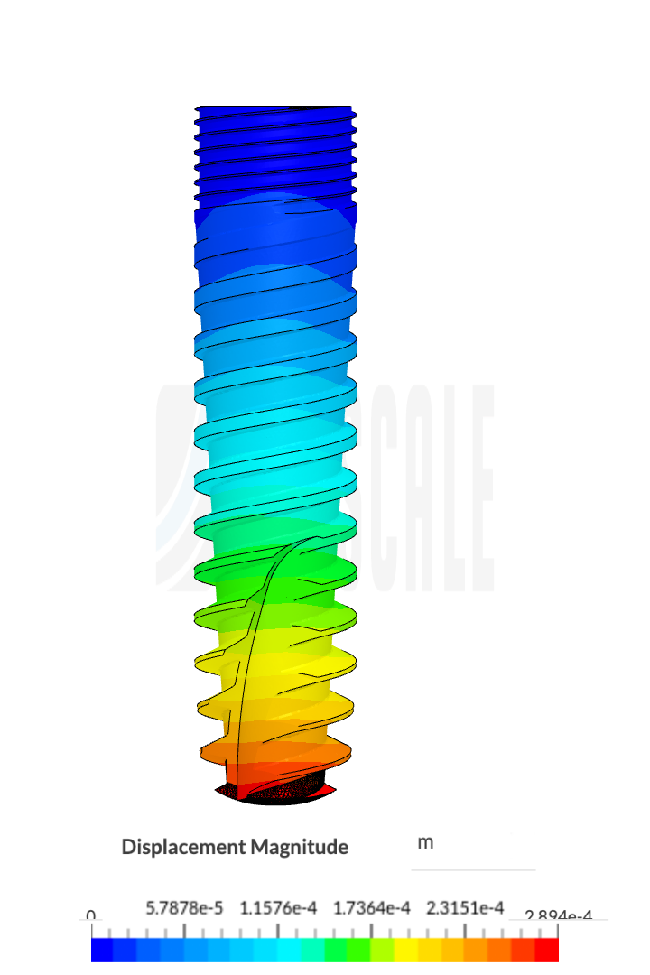 Dental implant image