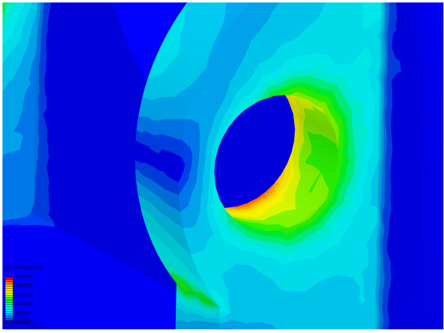 prothèse msv image