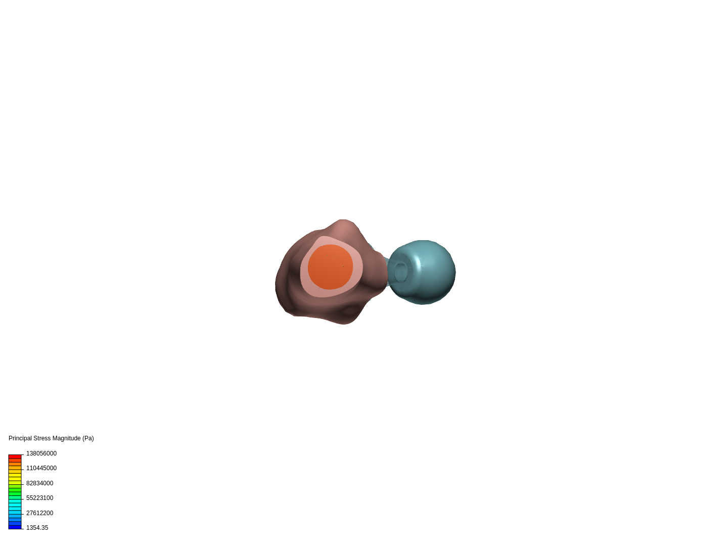 Hip Joint2 image