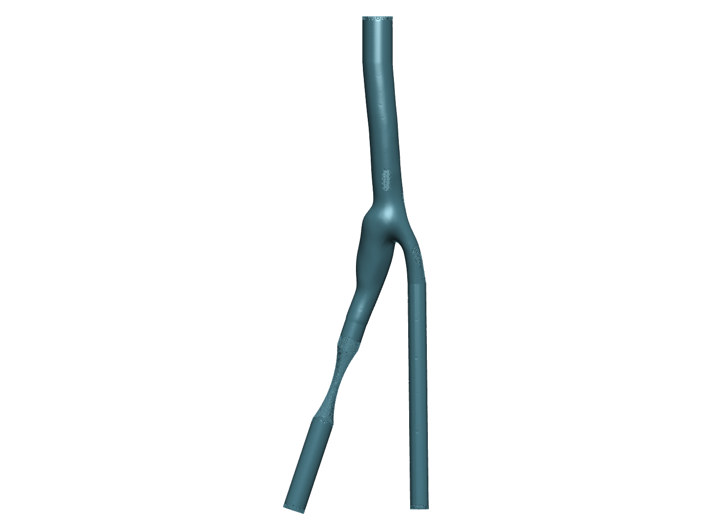 80 pc blocked Carotid artery bifurcation image