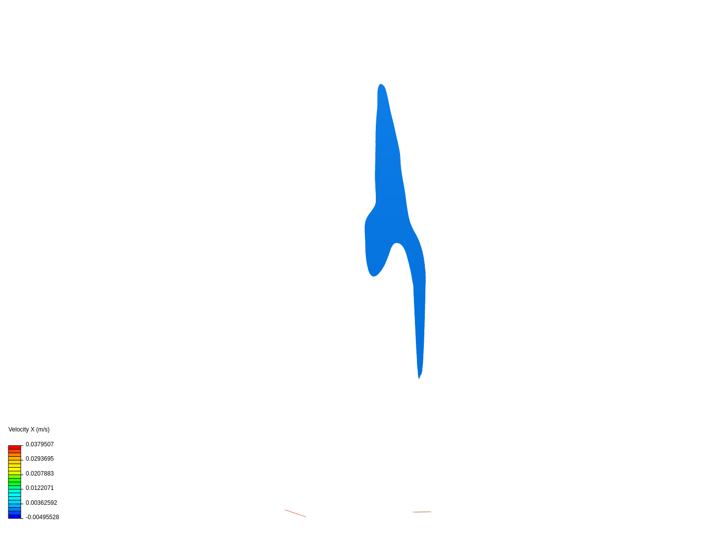 Carotid Artery Bifurcation image