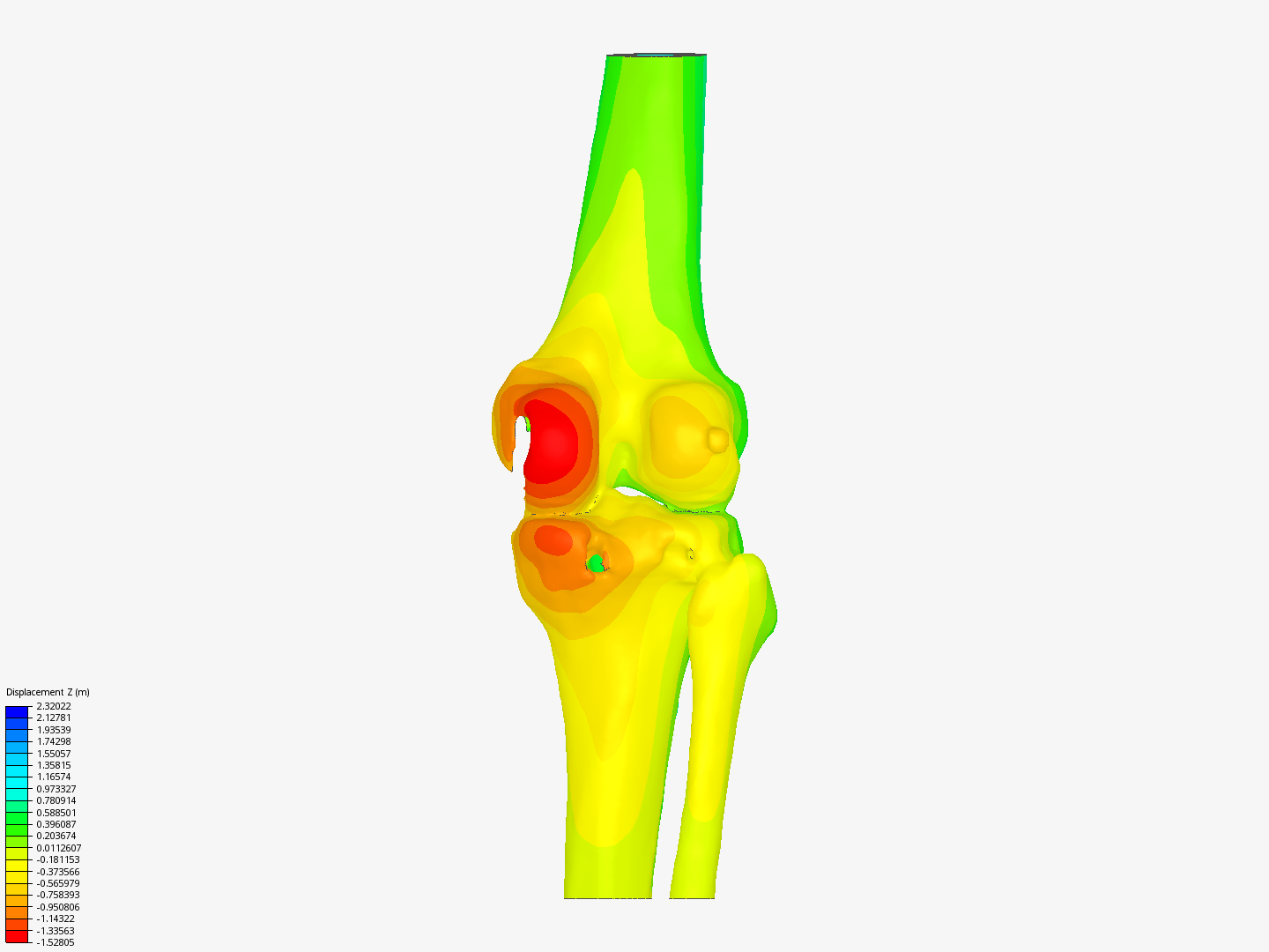 knee joint - Copy image