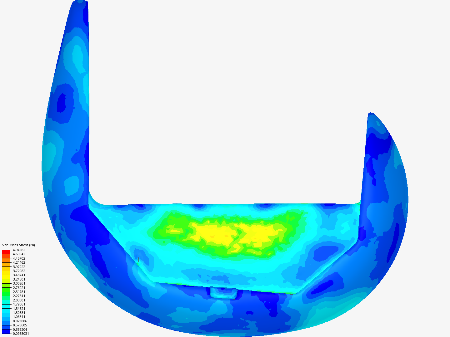 Prothesis image