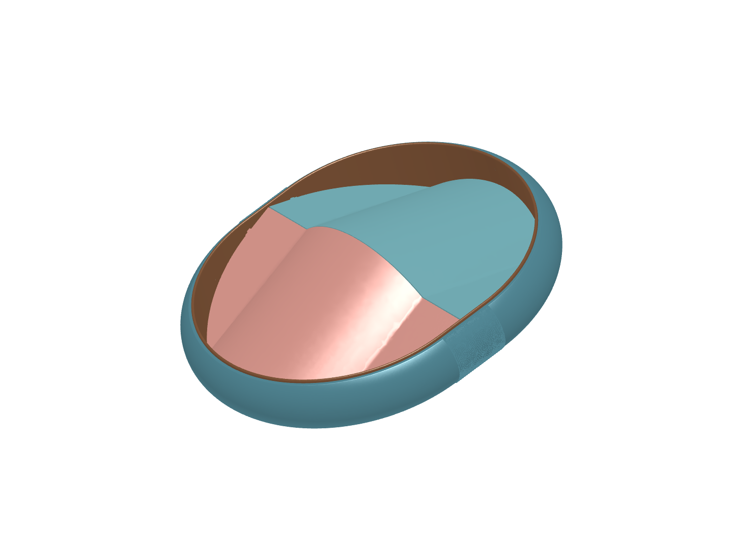 My mitral image