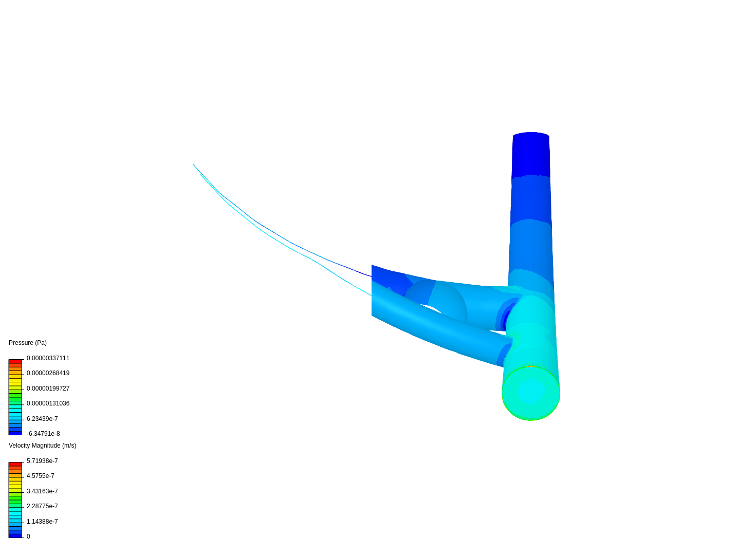 Stenosis and Bypass image