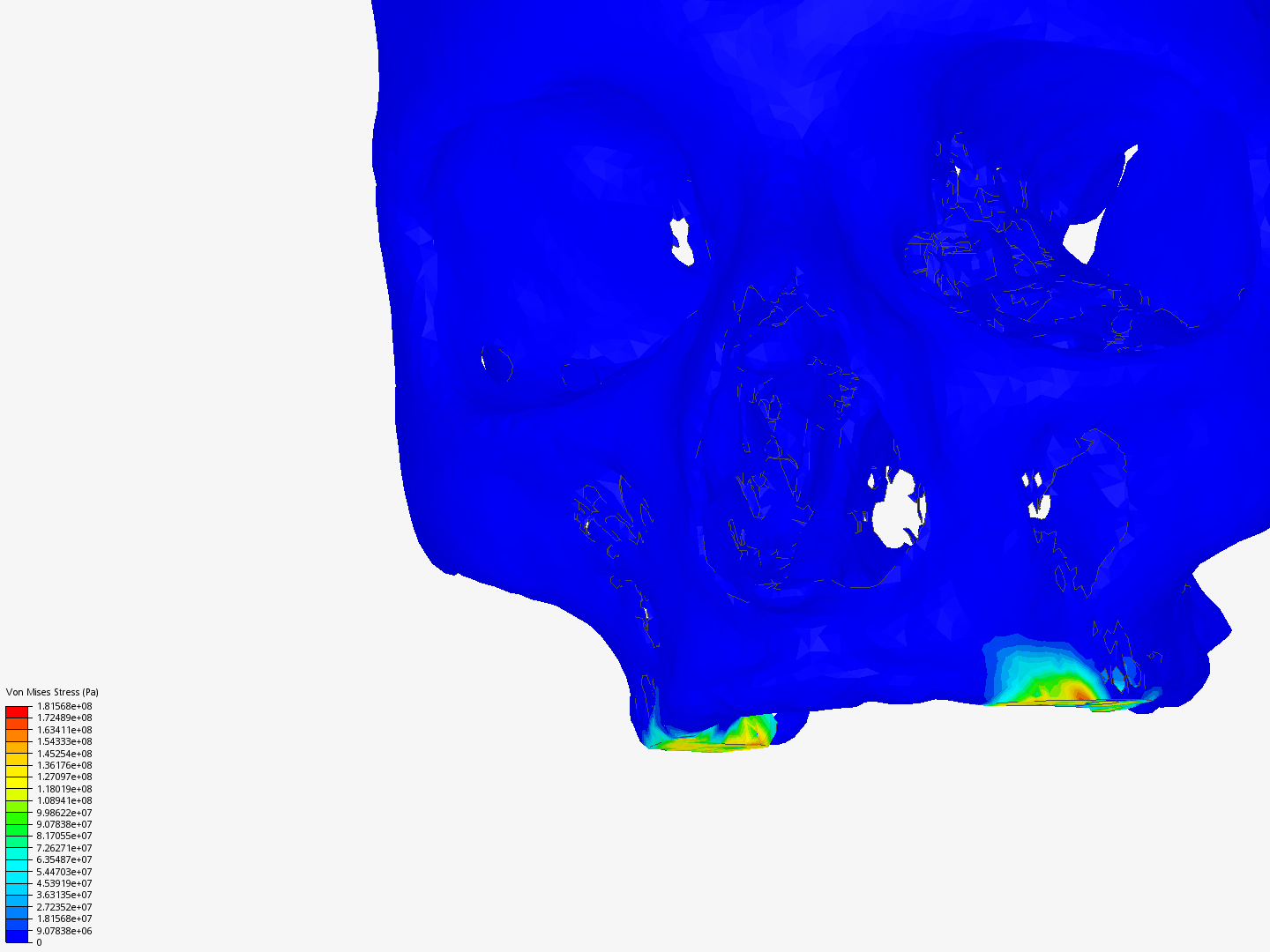 Cranial reconstruction image