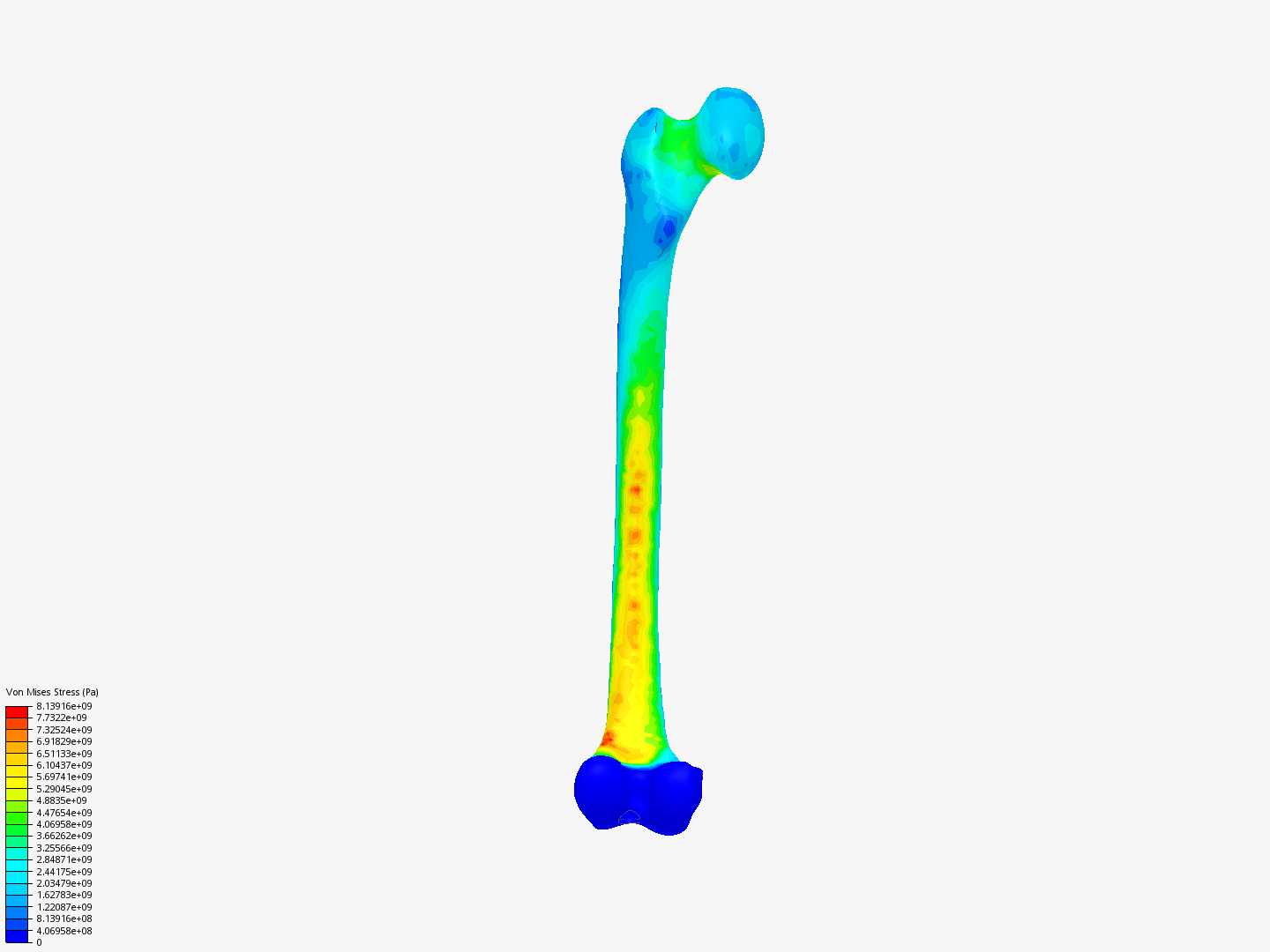 femur image