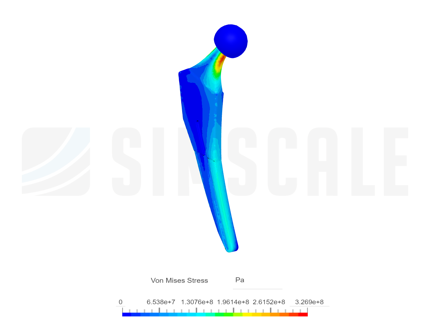 Femur Implant FYP image