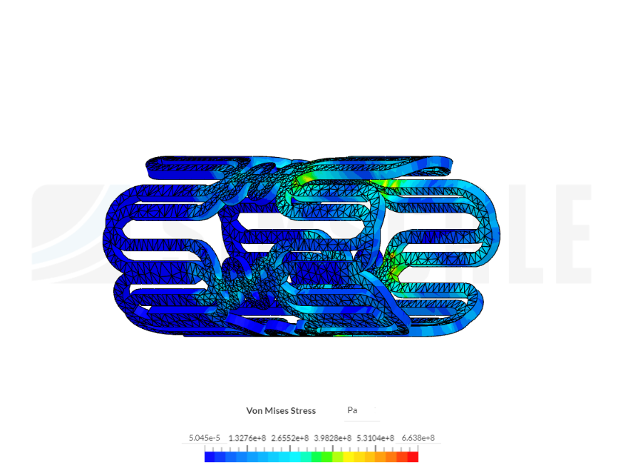 Stent 2 image