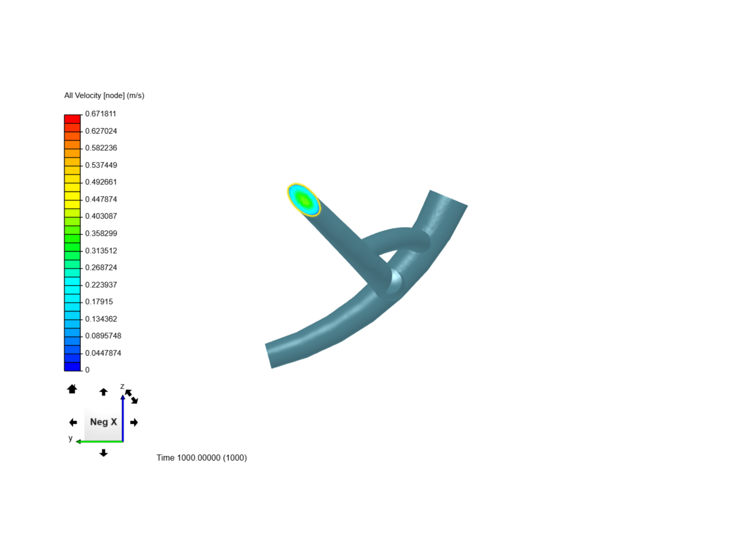 Stenosis MP3 image