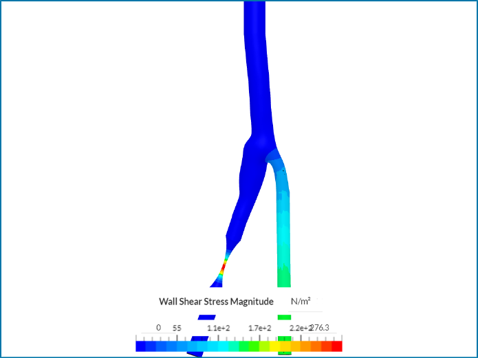 FINAL Occlusion Effect on WSS image