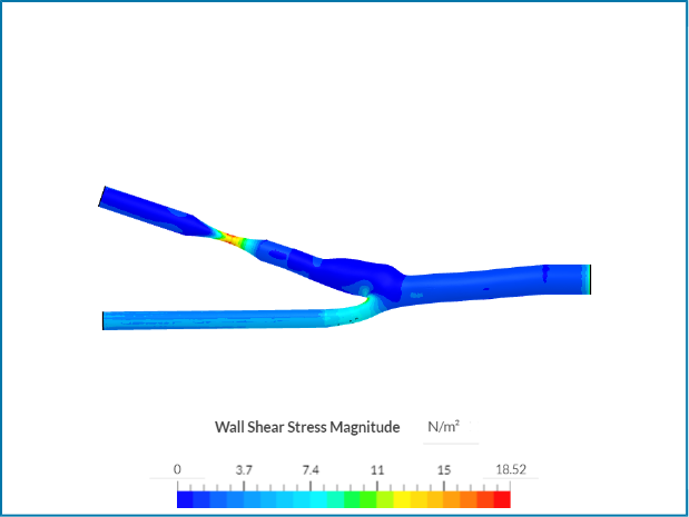 NEW Occlusion effect on wall shear stress image