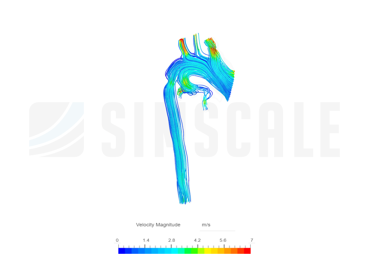 Patient-1 With PDA image