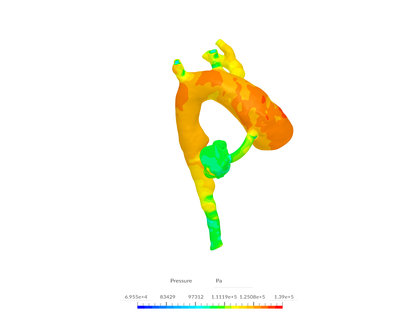 Patient2-NoPDA - Copy image