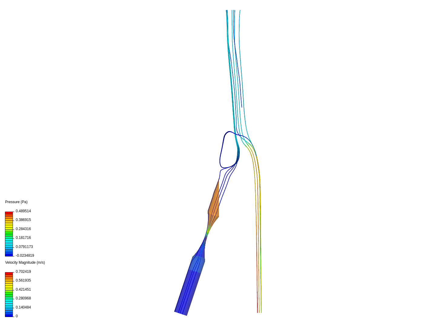 Blood flow in a Carotid Artery Bifurcation - Homework image