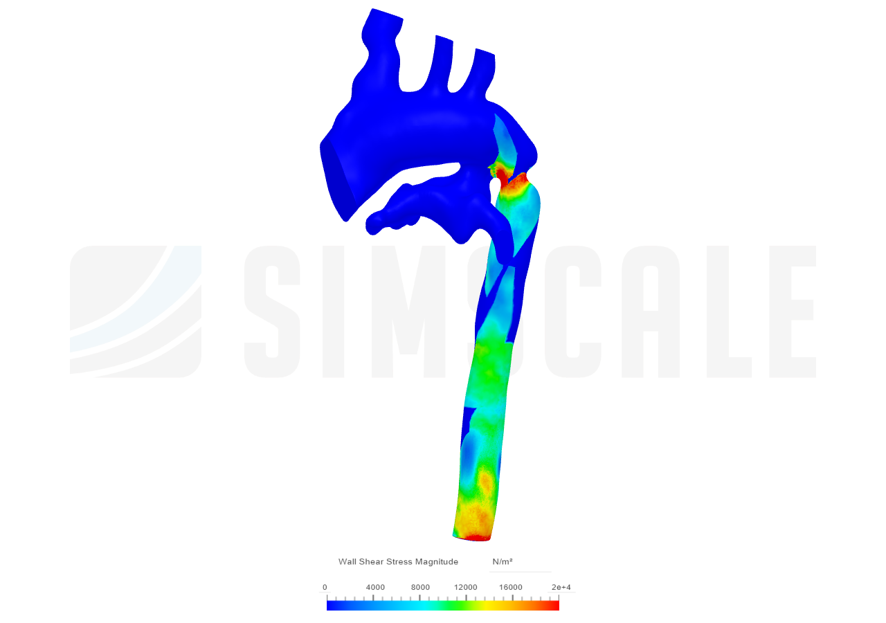 Patient-1 With PDA Opened image