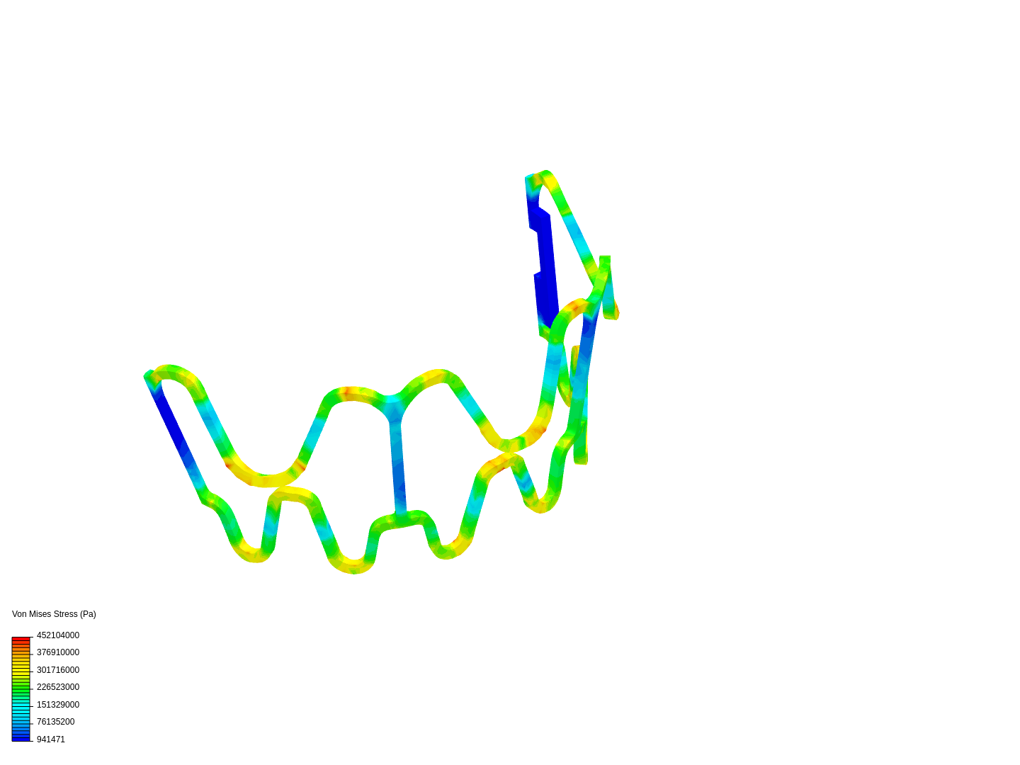 stent-f-t1 image